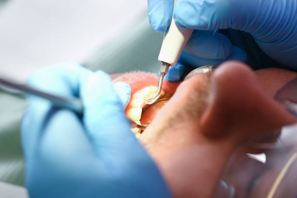 Best Emergency Dentist for Special Needs Patients in Caledonia, MI